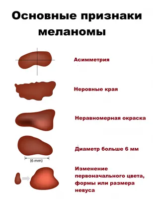 Мистическая красота черной родинки запечатлена на фото