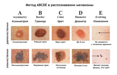 Обои Родинка черного цвета: придайте новый вид вашим домашним стенам