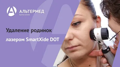 Full HD фотографии родинок с прозрачным фоном