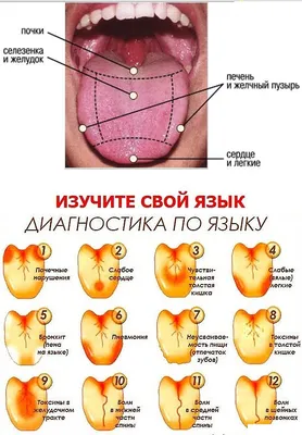 Изображения языка при раке желудка: выберите формат и качество