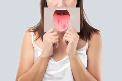 Цветовое преступление: съемка языка при раке желудка