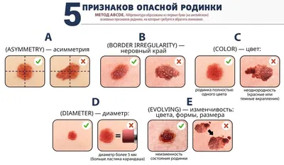 Обои на рабочий стол цвета языка при раке желудка