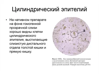 Удивительное открытие: фото демонстрирует, как свеколовый сок меняет цвет кала 