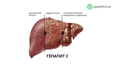 Фото и обои цвета кала при гепатите: бесплатно и легко скачать