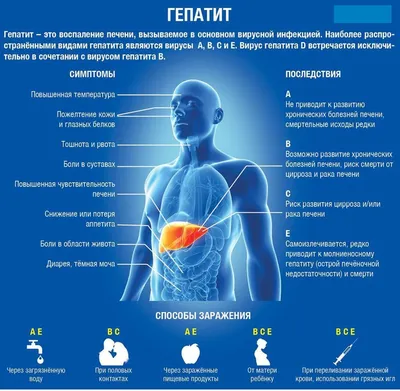 Загадочные снимки изменений цвета кала при гепатите