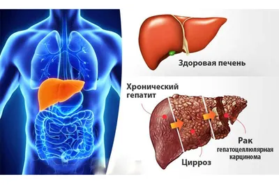 Фотографии цветов кала при гепатите: захватывающие изображения в HD!