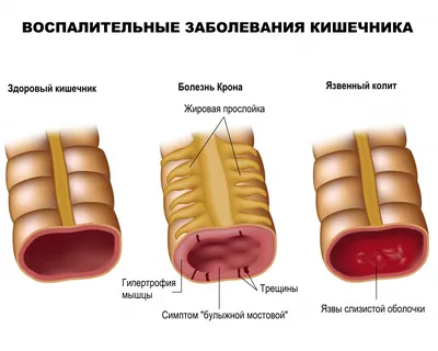 Изображения крови в арт-стиле: самые красивые и удивительные рисунки