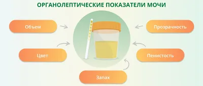 10. Фото Цвет мочи норма: Бесплатные фоны и обои в HD качестве