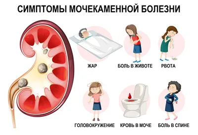 Цвета мочи: познакомьтесь с разнообразием и их значениями 