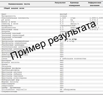 Картинка Цвет мочи норма: абстрактный арт с использованием насыщенных цветов