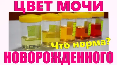 Фото андроид с идеальным цветом мочи – скачать бесплатно и просто!