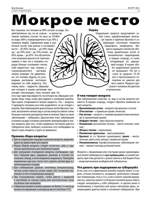 Фото Цвет мокроты при туберкулезе: скачать бесплатно в формате PNG