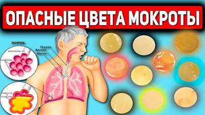 Цвета мокроты при туберкулезе: обзор на фото и картинках