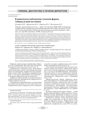 Картинка с цветной мокротой при туберкулезе: изображение на андроид.