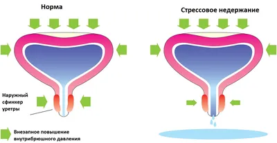 Фотография Цвет здоровой мочи на рабочий стол