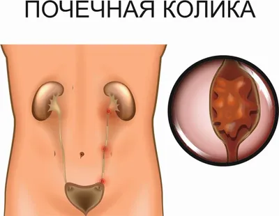 Экзотический солнечный желтый: когда моча приобретает насыщенность летнего неба