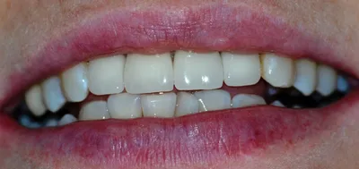 Живые цвета Цвет зубов а1: фото, которые заставят ваши глаза радоваться