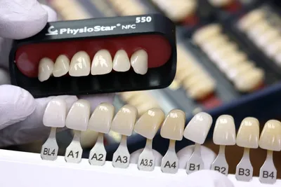 Фотографии Цвет зубов а1 в HD качестве: потрясающая детализация каждого оттенка