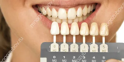 Изумительные оттенки цвета зубов а1 на фотографиях