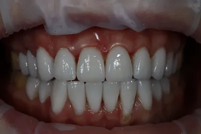Уникальная гамма цветов зубов а1 в захватывающих снимках