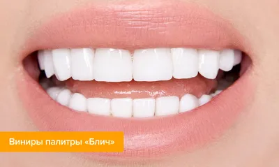 Новые фото Цвет зубов а1: скачать бесплатно в различных форматах