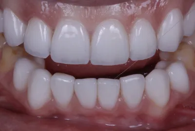 Подборка стильных обоев Цвет зубов а1: бесплатное скачивание в разных размерах