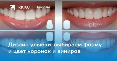 Фотк с цветом зубов b1: Full HD фотография для скачивания