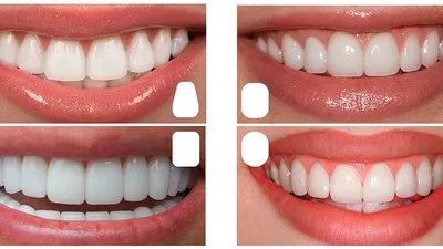 Фото Цвет зубов b1: самые качественные фотографии для скачивания