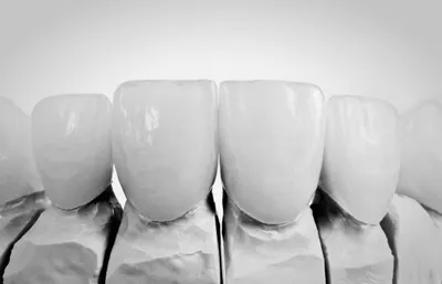 Фото Цвет зубов b1 2024: Прекрасные фотографии в gif формате