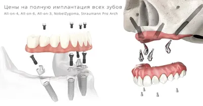 Налоговый вычет за лечение зубов в 2023 году: как получить социальный вычет  | НДФЛка