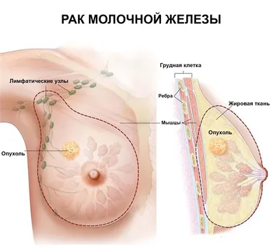 Купить Самоклеящийся силиконовый бюстгальтер для покрытия сосков груди,  натуральный цвет, один размер, наклейка на соски, нижнее белье | Joom