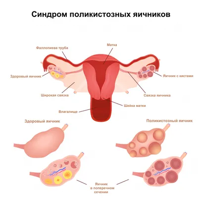 Силиконовые накладки на соски для кормления грудью при трещинах (для  проблемных плоских сосков) КАРТОФАН 111556148 купить в интернет-магазине  Wildberries