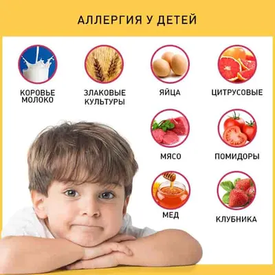 Какие фрукты можно есть при аллергии. Какие фрукты не вызывают аллергию.