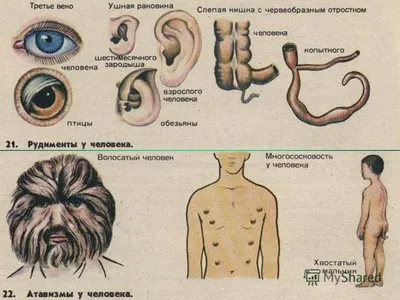 Атавизмы у человека фото