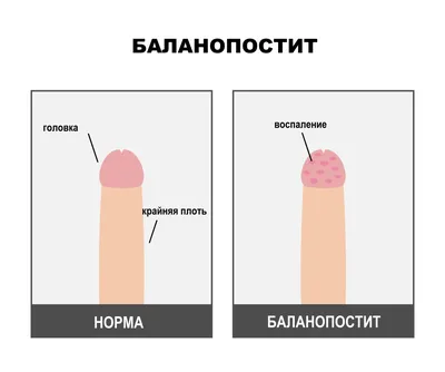 Баланопостит у собак: Фото для ветеринарных конференций