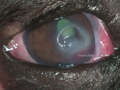 Изображения болезней глаз собак: в хорошем качестве и png