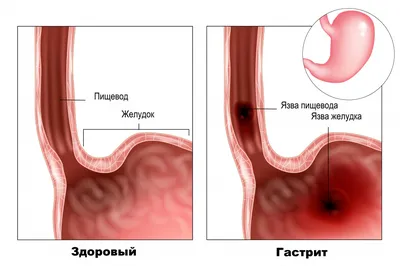 Сахарный диабет и кожа: диагностика и лечение кожных проявлений - Статьи -  Профессиональная косметика и материалы для эстетической медицины