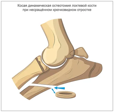 Бурсит у собак: фото для обучения ветеринаров