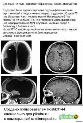 О голове (Сергей Голубев 2) / Стихи.ру