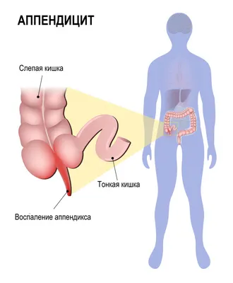 СУЩНОСТИ, ПОЖИРАЮЩИЕ ЭНЕРГИЮ ЛЮДЕЙ ИЗНУТРИ … | Наталья Бессонова | Дзен