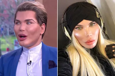 Human Ken Doll' Rodrigo Alves comes out as transgender, now identifies with  Barbie | Ken doll, Real barbie, Barbie and ken