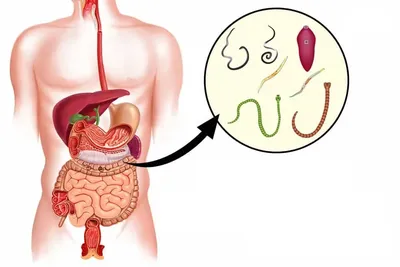 Черви в организме человека фото фотографии