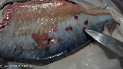 Заражение рыбными паразитами | Клиника Паразитологии в Одессе