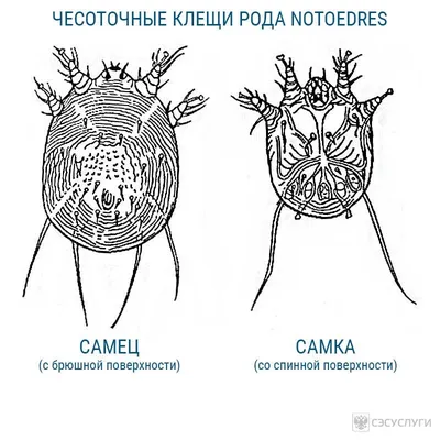 Лечение чесотки: практические советы — как лечить чесотку у детей и  взрослых, препараты и народные средства