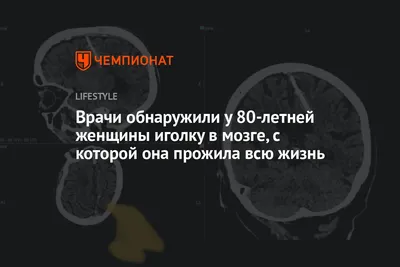 Нитковдеватель для иголки автоматический зеленый - купить с доставкой по  выгодным ценам в интернет-магазине OZON (1369914410)