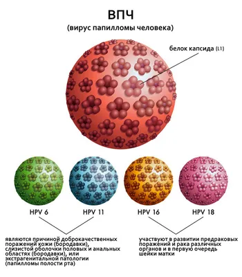 Вирус папилломы человека (ВПЧ): симптомы, причины, лечение