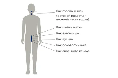 Папилломавирус человека - признаки, причины, симптомы, лечение и  профилактика - iDoctor.kz