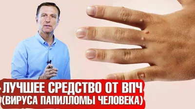 Навсегда с тобой. Все о вирусах папилломы человека | Доктор Море | Дзен