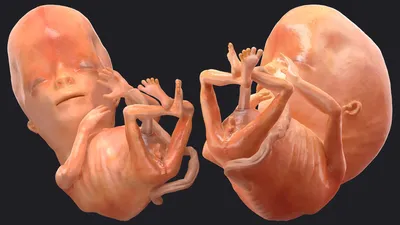 [69+] Эмбрион человека 12 недель фото фото