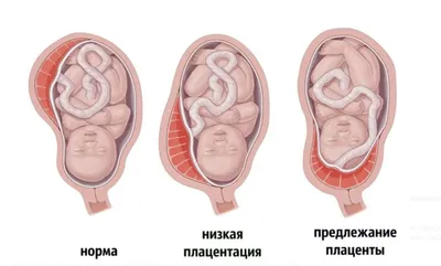 Эмбрион, 18 недель»: возможно, величайшая фотография XX-го века